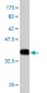 USP14 Antibody (monoclonal) (M08)
